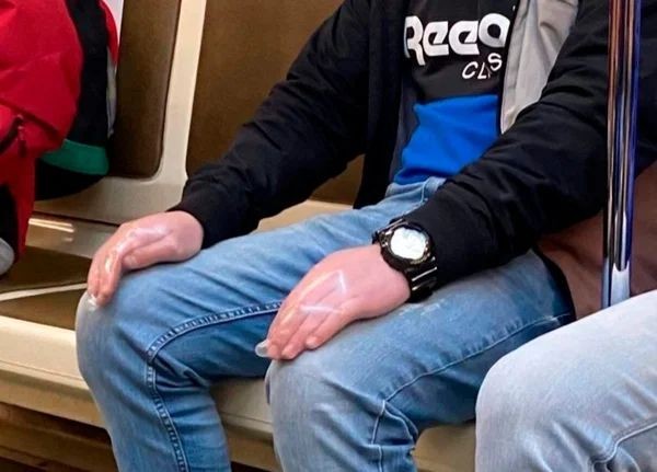 Covid-19_przed_nawrotem47